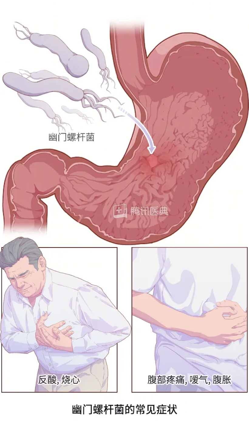 家人有幽門螺桿菌，一起吃飯會(huì)傳染給孩子嗎？